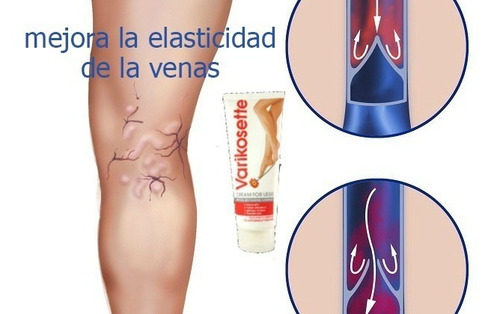 Varikosette - Hendel - Crema Para Venas Varicosas, Varices