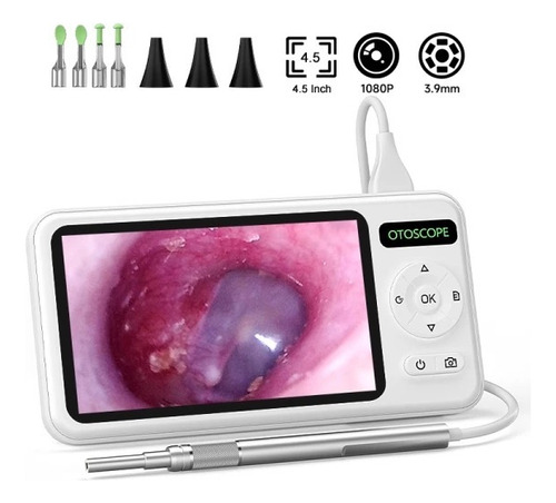 Otoscopio Digital Pantalla Ips 4.5 Pulg, 3.9 Mm Recargable