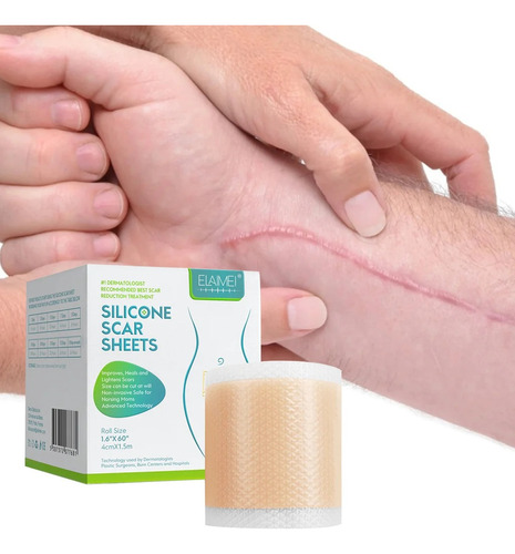 Parches Autoadhesivos Para Eliminacion De Cicatrices 1,5 Cm