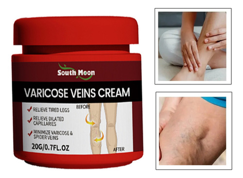 Crema Para Varices, Trombosis, Vasculitis Natural