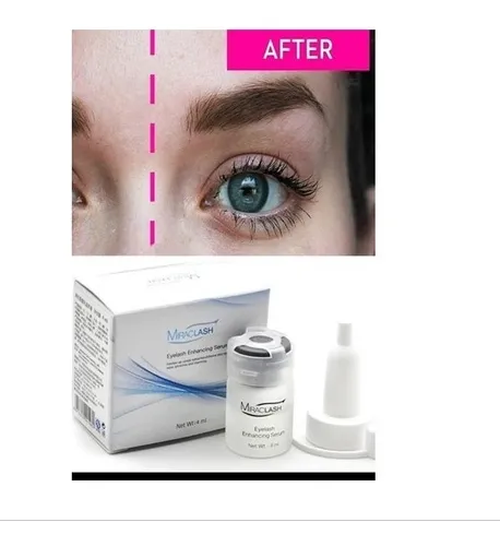 Miraclash Para Crecimiento De Pesta as Cuotas sin inter s