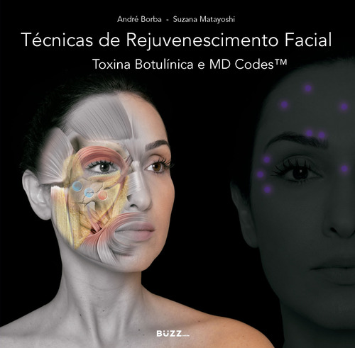 Técnicas de rejuvenescimento facial: Toxina botulínica e MD Codes, de Borba, André. Editora Wiser Educação S.A, capa dura em português, 2018