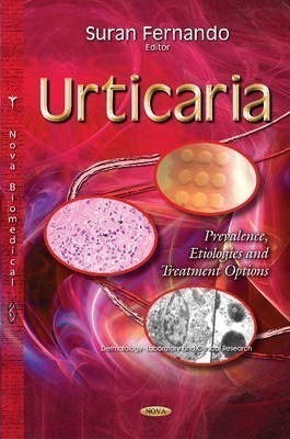 Urticaria - Suran Fernando (hardback)