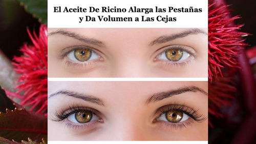 Sérum Para Crecimiento De Pestañas Zunne Resultados!!!