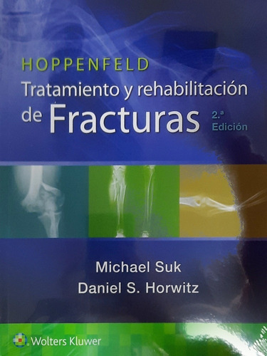 Hoppenfeld Tratamiento Y Rehabilitación De Fracturas 2 Ed