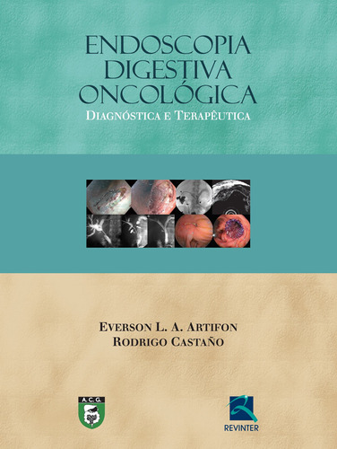 Endoscopia Digestiva Oncológica: Diagnóstico e Terapêutica, de Artifon, Everson L. A.. Editora Thieme Revinter Publicações Ltda, capa dura em português, 2015