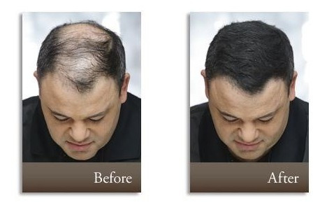 Toppik Gel Engrosador