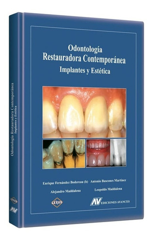 Libro Odontología Restauradora Contemporánea