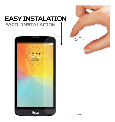 Protector Pantalla Antishock Para LG L Bello