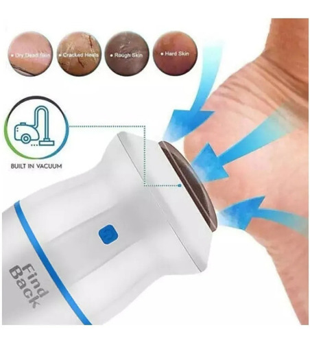 Imagen 4 de 10 de Removedor De Callos Pedicure Electrico Exfoliante De Pies