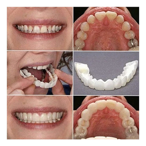 1 Par De Dentaduras Postizas Artificiales De Silicona