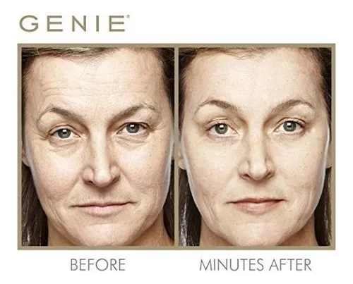 Genie Instant Line Smoother, 19 Ml/.63 F