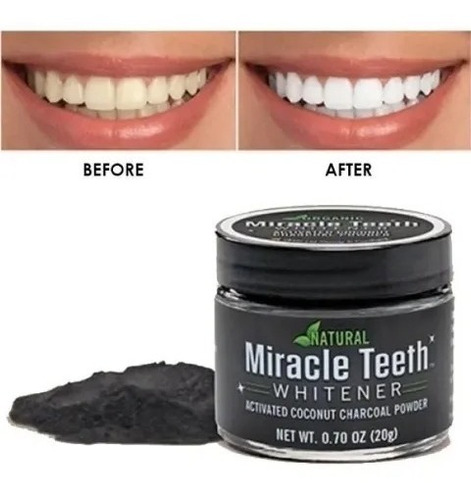 Pasta Blanqueador Dental Miracle Teeth - Carbon - Limpieza