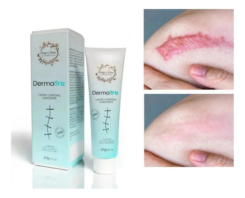 Pomada Creme Redutor De Cicatriz Estrias Dermatriz 20g.