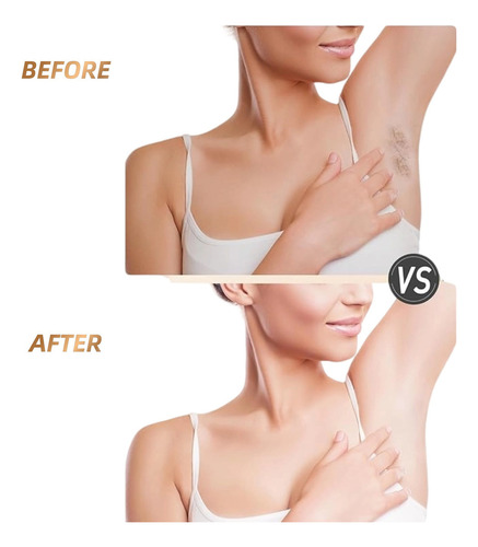 Ipl Permanent Pulsed Light Laser Painless Epilator