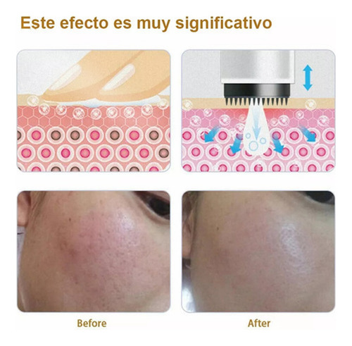 10 Repuestos Para Dermapen Dr Pen M7, Mym Y N2. De 42 Pin