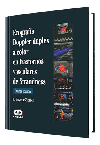 Ecografía Doppler Duplex En Trastornos Vasculares Strandness