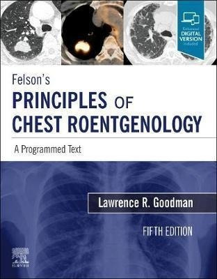 Felson's Principles Of Chest Roentgenology, A Programmed ...