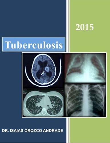 Libro: Tuberculosis 2015 (spanish Edition)