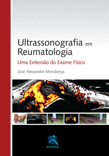 Ultrassonografia em Reumatologia, de Mendonça, José Alexandre. Editora Thieme Revinter Publicações Ltda, capa dura em português, 2013