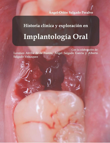 Libro: Historía Clínica Y Exploración En Implantología Oral