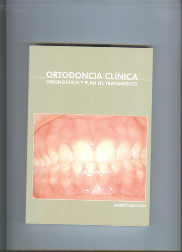 Ortodoncia Clínica Diagnostico Y Plan De Tratamiento: Diagnostico Y Plan De Tratamiento, De Alberto Baggini. Serie 1, Vol. 1. Editorial Nobuko, Tapa Blanda, Edición 1 En Español, 2002