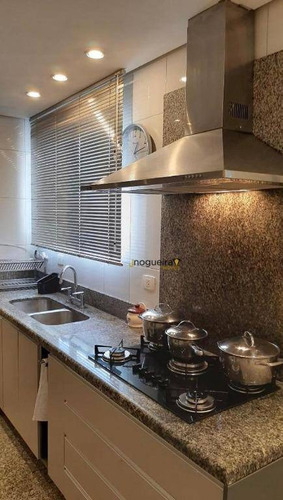 Imagem 11 de 26 de Apartamento 4 Dormitórios 3 Suítes Vila Mascote - Ap14471