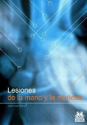 Lesiones De La Mano Y La Muñeca