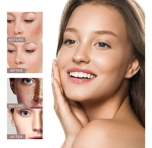 Creme Facial Clareador Hidratante, Clareador E Clareador Fac