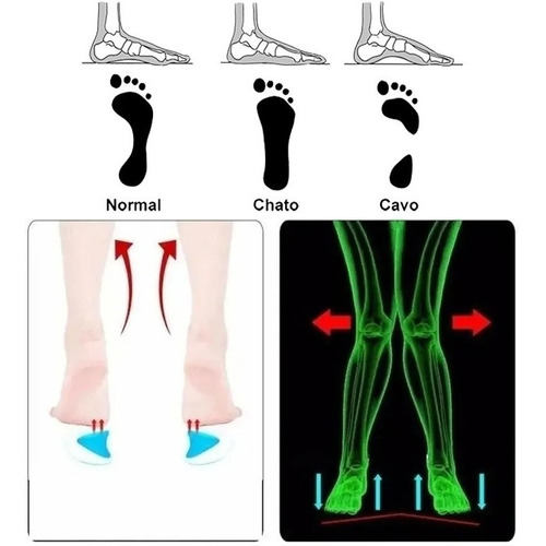 Imagem 6 de 8 de Palmilha Para Pé Plano Ortopédica De Gel Silicone
