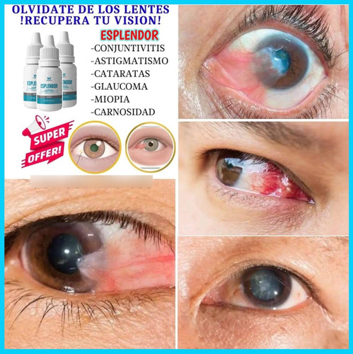 Esplendor, Gotas Para Cuidar Tus Ojos