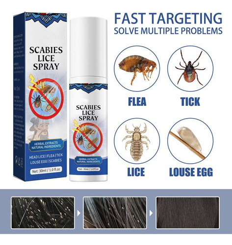 Spray De Eliminación Para Niños, Spray Para Piojos, Para Asu