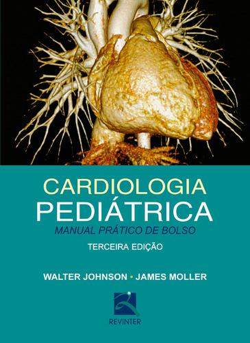 Cardiologia Pediátrica: Manual Prático de Bolso, de Johnson, Walter. Editora Thieme Revinter Publicações Ltda, capa mole em português, 2016