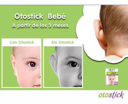 CORRECTOR DE OREJAS OTOSTICK bebé 8 UDS DESDE 3 MESES DE EDAD