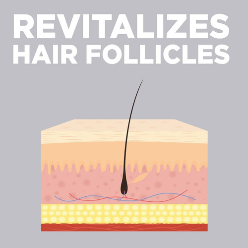 Imagen 3 de 5 de Member's Mark Minoxidil 5% Solución Tópica 6 Meses * Krklnd