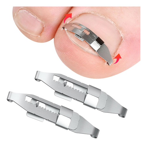 2 Uds Herramientas De Corrección De Uñas Encarnadas Clips