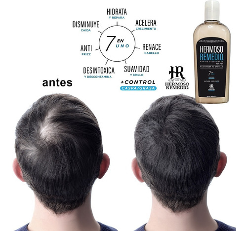 Imagen 3 de 6 de Shampoo Anticaida Crecimiento Reparador Hidratante 7 En 1