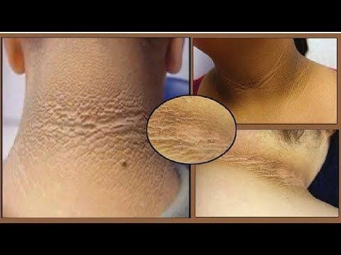 Imagen 2 de 8 de Dermisa Crema Aclaradora
