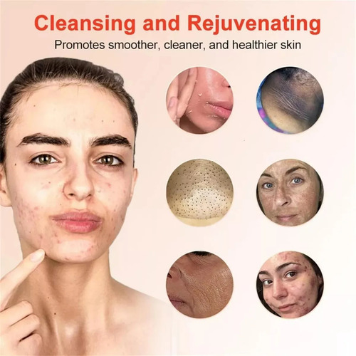 Gel Exfoliante Purificante Quarxery