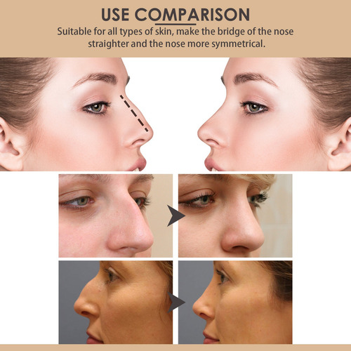 E 30 Ml Nasal Mejora La Forma Y Del Nasal 8031