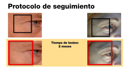 Peptisomas Crema Rejuvenecedora Flacidez Arrugas Lidherma