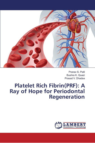 Libro: Platelet Rich Fibrin(prf): A Ray Of Hope For