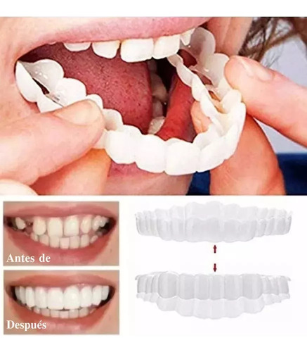 Dentaduras Dentárias Falsas De Silicone Perfect Smile.