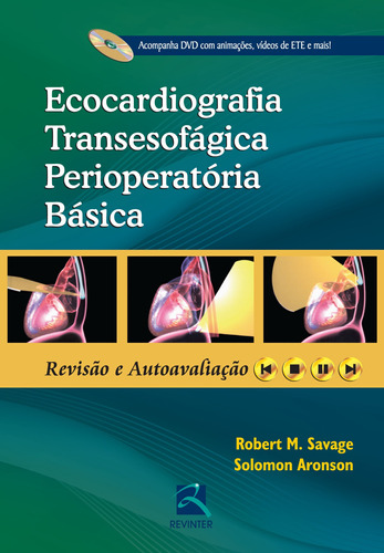 Ecocardiografia Transesofágica Perioperatória Básica, de Savage, Robert M.. Editora Thieme Revinter Publicações Ltda, capa dura em português, 2014