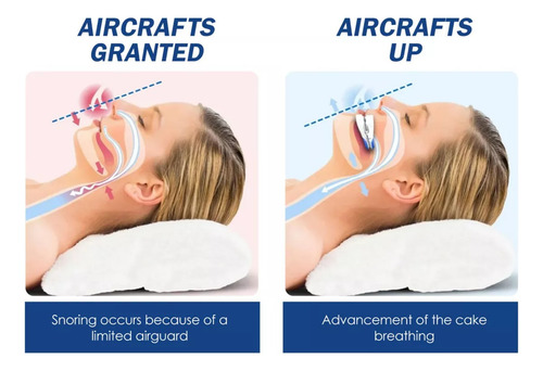 Dispositivos Antirronquidos Solution For Ronquidos Snore 1ud