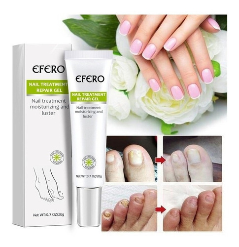 Gel De Uñas Efero: Tratamiento Eficaz Para Micrófono