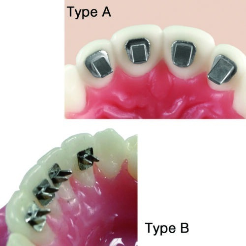 Bite Turbo/ Topes Para Ortodoncia X10uni.