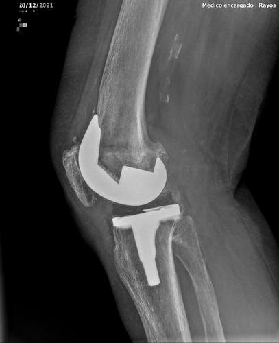 Imagen 7 de 8 de Radiografías Digitales A Domicilio Humanos Y Animales