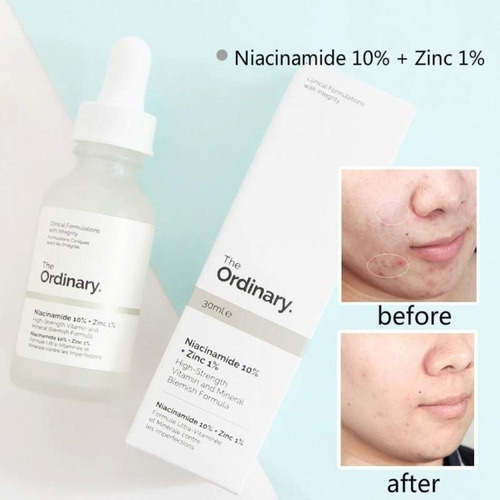 The Ordinary Niacinamida 10% + Zinc 1% - Niacinamida 30 Ml