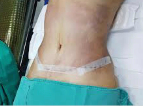 Imagen 2 de 3 de Masajes -pos Operatorios